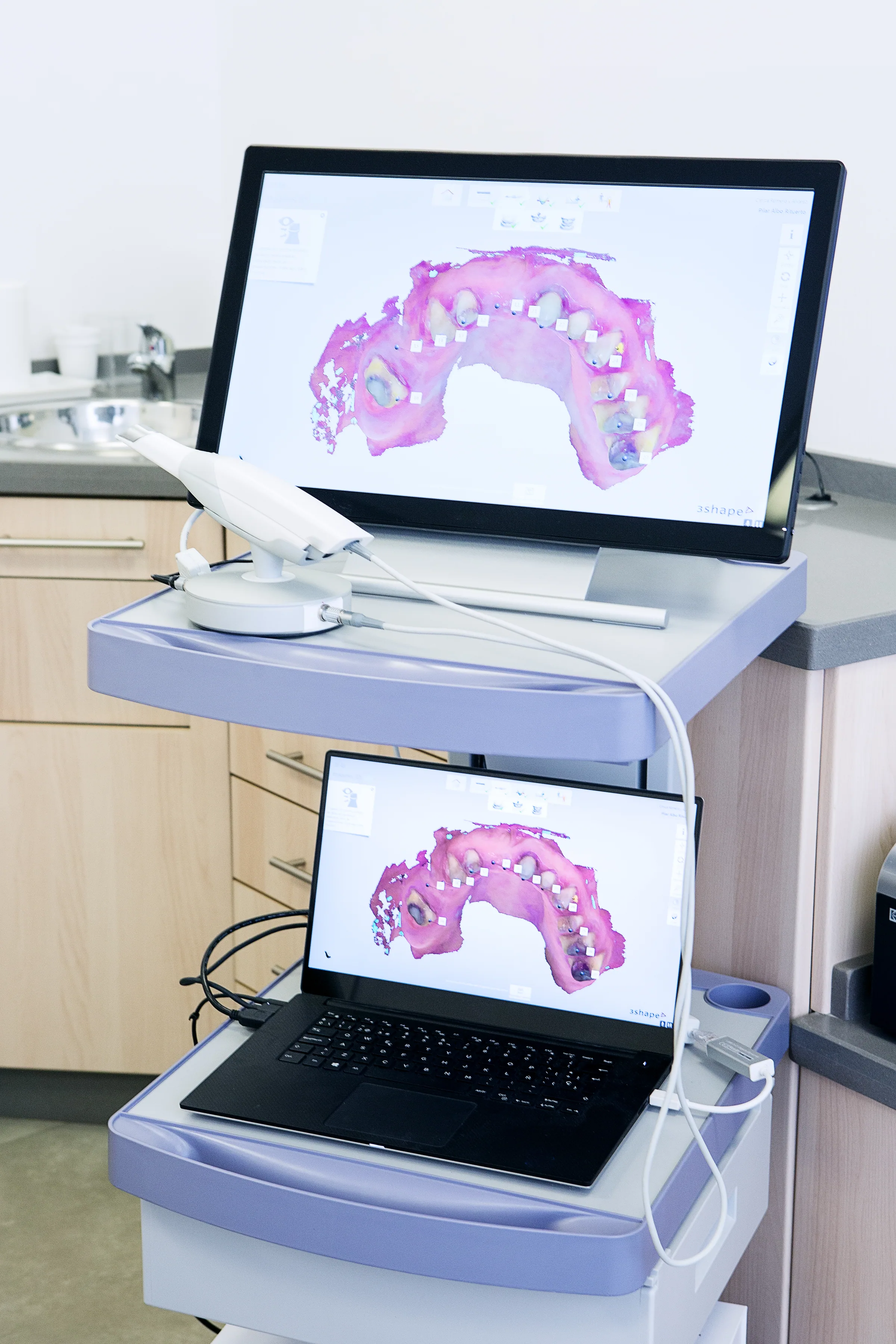 Scanner intra-oral 3D